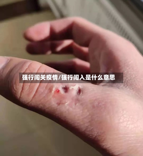 强行闯关疫情/强行闯入是什么意思