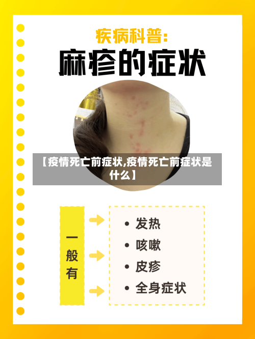 【疫情死亡前症状,疫情死亡前症状是什么】