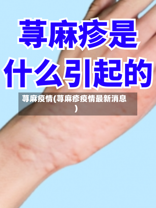 荨麻疫情(荨麻疹疫情最新消息)-第3张图片
