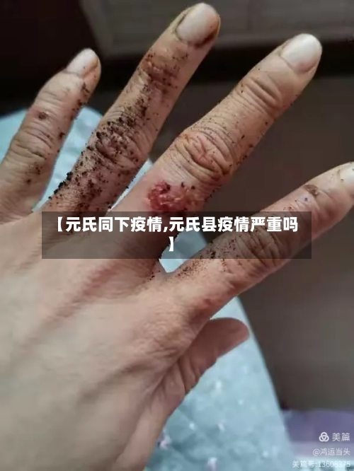 【元氏同下疫情,元氏县疫情严重吗】
