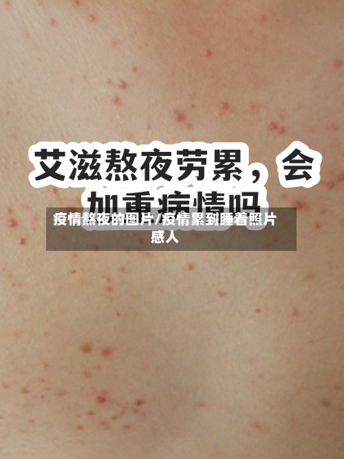 疫情熬夜的图片/疫情累到睡着照片感人